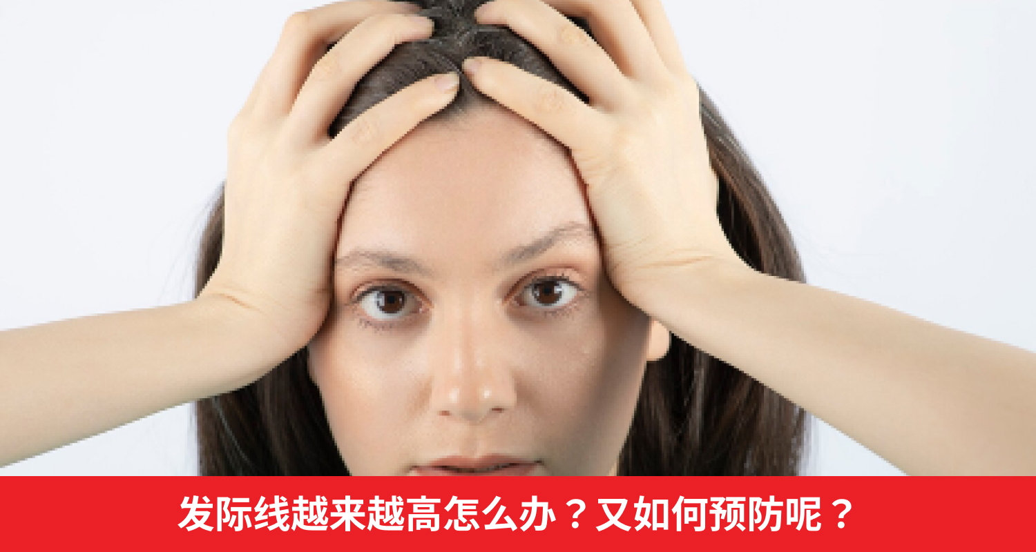 发际线越来越高怎么办?又如何预防呢?