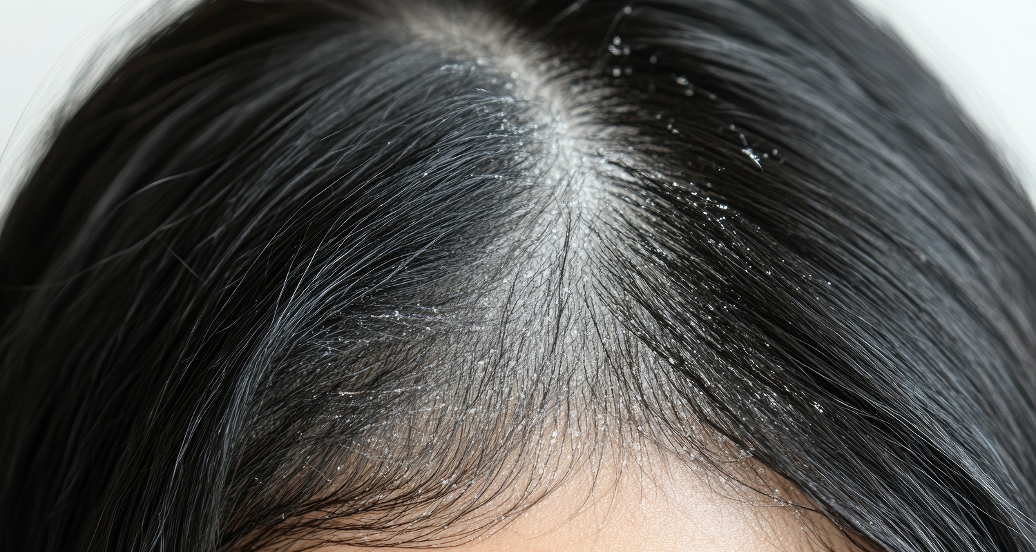 为什么有些人做了却没效果？常见误区一次讲清楚